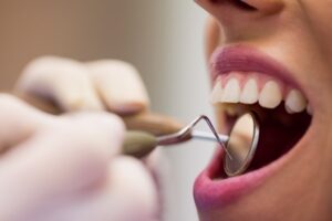 dentes terapia neural