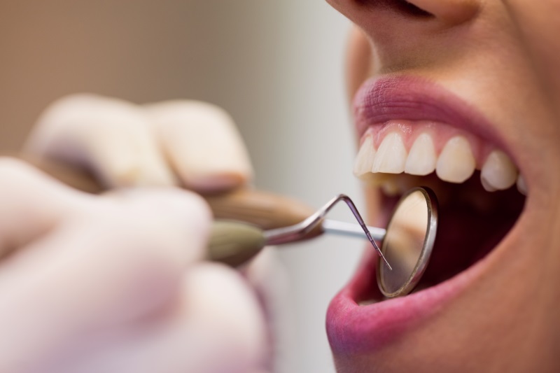 dentes terapia neural
